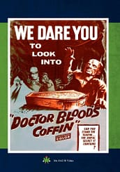 Dr. Blood's Coffin (1961) starring Kieron Moore, Hazel Court